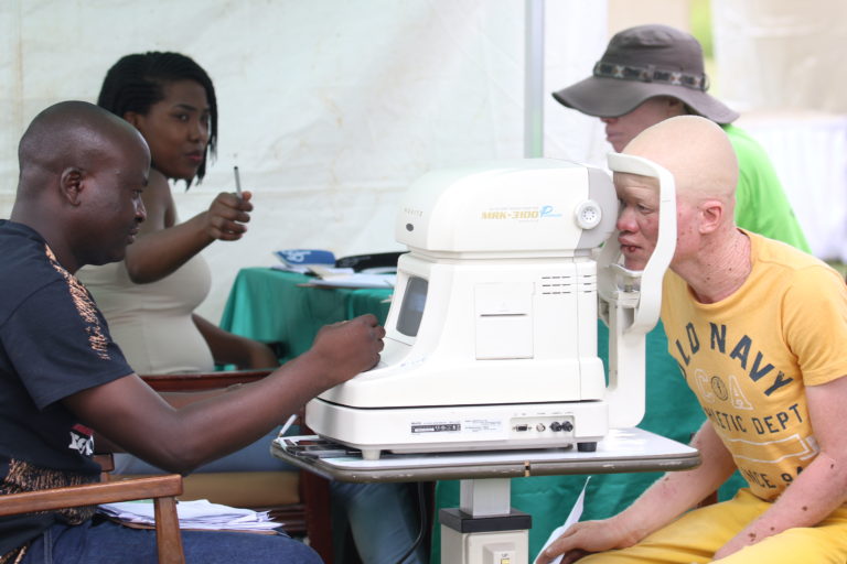 Escalating Discrimination Against People With Albinism In Zimbabwe